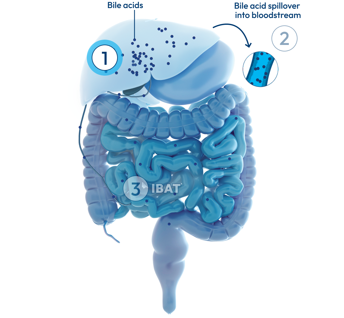 Graphic of the liver and intestines, with a number 1 representing bile acids and bile ducts.